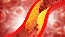 Cara Menurunkan Kolesterol Secara Alami