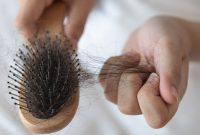 Kenapa Rambut Rontok Parah