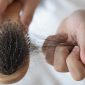 Kenapa Rambut Rontok Parah