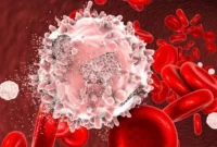 Leukosit Tinggi Kenapa?