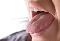 Kenapa Air Liur Keluar Terus Saat Puasa