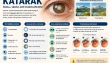 Katarak: Kenali Penyebab, Gejala, dan Cara Mengatasi Mata Katarak Sejak Dini